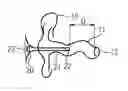 Fig. 01 - APPARATUS AND METHOD FOR MEASURING A DISTANCE TO AN EARDRUM