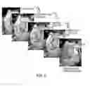 Fig. 08 - Method and system for dynamic pulmonary trunk modeling and intervention planning
