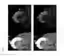 Fig. 05 - Method and system for automatic aorta segmentation