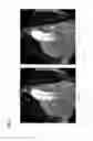 Fig. 06 - Method and system for automatic aorta segmentation