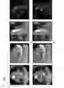 Fig. 07 - Method and system for automatic aorta segmentation