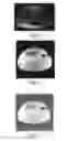 Fig. 09 - B1 and/or B0 mapping in MRI system using k-space spatial frequency domain filtering with complex pixel by pixel off-resonance phase in the B0 map