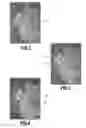 Fig. 03 - METHOD AND A DEVICE FOR PRODUCING A COMPOSITE IMAGE OR A COMPOSITE SEQUENCE OF IMAGES INDUCING ENHANCED PERCEPTION OF THE RELIEF OF AT LEAST ONE SUBJECT