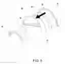 Fig. 08 - Streamer connection system
