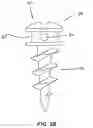 Fig. 06 - SUPPORTING DEVICE