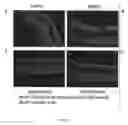 Fig. 02 - Methods and compositions for genetic and retinal disease