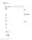 Fig. 06 - Dual specificity antibody fusions