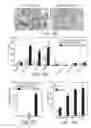 Fig. 04 - GRP78 AND TUMOR ANGIOGENESIS