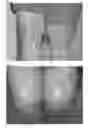 Fig. 02 - Methods and compositions for wound healing