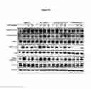 Fig. 29 - EGFR/NEDD9/TGF-BETA INTERACTOME AND METHODS OF USE THEREOF FOR THE IDENTIFICATION OF AGENTS HAVING EFFICACY IN THE TREATMENT OF HYPERPROLIFERATIVE DISORDERS
