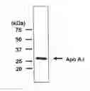 Fig. 01 - Liposome for liver-specific delivery and release of therapeutic nucleic acids or drugs