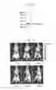 Fig. 02 - Liposome for liver-specific delivery and release of therapeutic nucleic acids or drugs