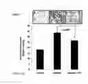 Fig. 12 - Flaxseed lignan complex, methods of using and compositions thereof