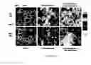 Fig. 13 - Flaxseed lignan complex, methods of using and compositions thereof