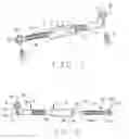 Fig. 02 - Jaw advancer connected to bone