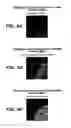 Fig. 07 - HUMAN ANTIBODIES THAT HAVE MN BINDING AND CELL ADHESION-NEUTRALIZING ACTIVITY