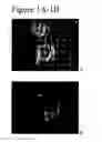 Fig. 02 - Blastomere culture to produce mammalian embryonic stem cells
