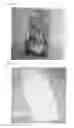 Fig. 07 - Via Using Zn or Zn Alloys and Its Making Method, 3D Chip Stack Packages Using Thereof