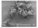 Fig. 01 - Semi-crystalline absorbable microspheres