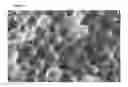 Fig. 04 - Semi-crystalline absorbable microspheres