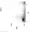 Fig. 05 - METHOD FOR PURIFYING CANCER-SPECIFIC PROLIFERATING CELL NUCLEAR ANTIGEN