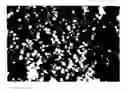Fig. 01 - Tissue Augmentation Material And Method