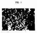 Fig. 02 - Tissue Augmentation Material And Method