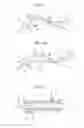 Fig. 08 - Endoscopy method and endoscope