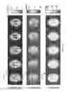 Fig. 08 - Multi-phase pseudo-continuous arterial spin labeling