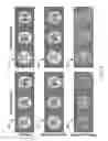 Fig. 09 - Multi-phase pseudo-continuous arterial spin labeling