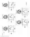 Fig. 25 - Multi-phase pseudo-continuous arterial spin labeling