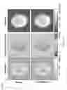 Fig. 28 - Multi-phase pseudo-continuous arterial spin labeling