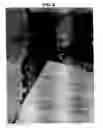 Fig. 09 - Robot for computed tomography interventions
