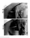 Fig. 10 - Robot for computed tomography interventions