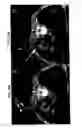 Fig. 11 - Robot for computed tomography interventions