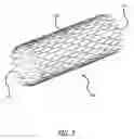Fig. 04 - OSTIAL LESION STENT DELIVERY SYSTEM