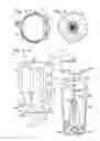 Fig. 02 - Intravitreal injection devices and methods of injecting a substance into the vitreous chamber of the eye