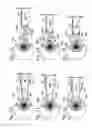 Fig. 05 - Intravitreal injection devices and methods of injecting a substance into the vitreous chamber of the eye