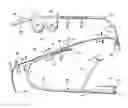 Fig. 01 - Insertion system and methods for nasogastric tubes