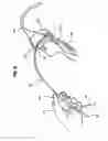 Fig. 08 - Insertion system and methods for nasogastric tubes