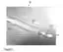 Fig. 05 - Trauma nail accumulator