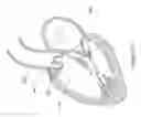 Fig. 131 - Inflatable medical devices
