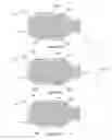 Fig. 68 - Inflatable medical devices
