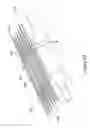 Fig. 70 - Inflatable medical devices