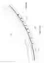 Fig. 89 - Inflatable medical devices