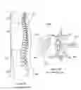 Fig. 90 - Inflatable medical devices