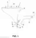 Fig. 02 - Flushing arrangement for a WC, and method of operating such a flushing arrangement