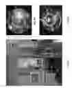 Fig. 07 - Permeate flow distribution measurement in a membrane filtration system