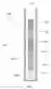 Fig. 10 - Sorbent devices with longitudinal diffusion paths and methods of using them