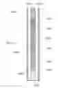 Fig. 12 - Sorbent devices with longitudinal diffusion paths and methods of using them